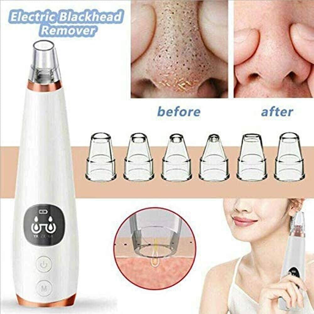 Blackhead Remover wholesale bulk stock carton boxes